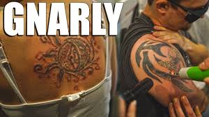 Best candidates for tattoo removal. Incredibly Painful Laser Tattoo Removal Youtube