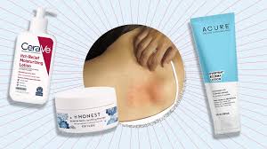 Cake beauty heavy cream intensive body balm. Best Eczema Lotion Products For Treating Dry Skin In 2020 Stylecaster