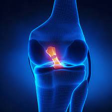 Each ace in an acl identifies a trustee and specifies the access rights allowed, denied, or audited for that trustee. Anterior Cruciate Ligament Symptoms Damage And Acl Reconstruction
