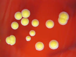 Image result for Staphylococcus Saprophyticus