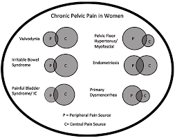 Pin On Chronic Pain Syndromes