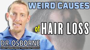 Stress is a natural part of life, but in some cases, it can lead to a rapid, temporary form of hair loss. Your Hair Loss May Be Reversible If It Is A Result Of These Weird Causes Gluten Free Society