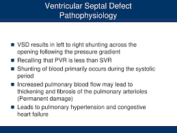 ret 300 congenital heart defects ppt download