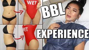 Most clients describe this as a tingling sensation. Brazilian Butt Lift Bbl Surgery Experience Vlog Elite Aftercare Youtube