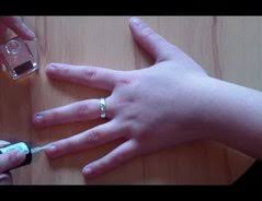 Abgekaute Fingernägel - das hilft beim Wachsen