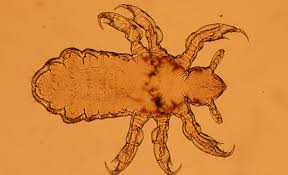 Daca visezi lume multa, multi oameni inseamna necazuri, tristete, poate chiar un deces, dezamagiri, deznadejde. Ce Inseamna Cand Visezi Paduchi Mesajele Ascunse De Care Trebuie Sa Tii Cont Sfatulparintilor Ro