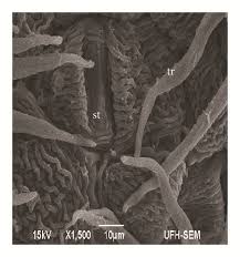 Image result for Phragmanthera capitata