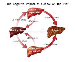 (vertical and horiztonal section, anterior and interior surfaces, and a detail cutaway showing interior ducts.) Liver Diagram Stock Illustrations 3 858 Liver Diagram Stock Illustrations Vectors Clipart Dreamstime