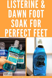 Vinegar has been used for years to treat toenail fungus, so if you are a person who is suffering from toe nail infection, then this listerine and vinegar foot soak will work beautifully for you. Do You Love Foot Soaks Wishing You Could Get Beautiful Feet Without Paying All Of That Money For A Pedicure If So Ch Listerine Foot Soak Listerine Foot Soak
