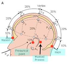 The International 10 20 System Of Electrode Placement