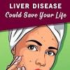 Liver cancer can be primary (starts in liver) or secondary. 1