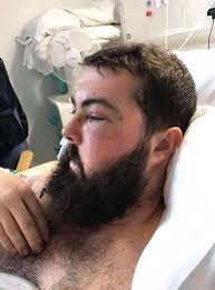 Man suffered severe facial injuries after car hit him