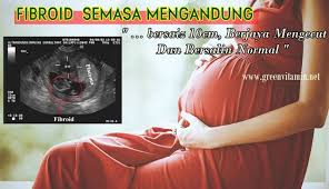 Bagaimana boleh vitamin kecutkan fibroid? Account Suspended Fibroids Info Movies
