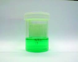 Urobilin merupakan bahan kumuhan daripada proses pecahan hemoglobin dalam sel darah merah. Waspadai Kesehatanmu Dari 7 Jenis Warna Urine Ini Mulai Tanda Dehidrasi Hingga Gejala Lever Dibahas Di Sini