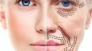 Best lash lifts and eyelash perming near me in Little Chell and Stanfield,  Stoke-on-trent