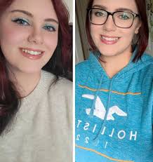 How to lose face fat?