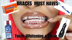 Here's how to whiten teeth with braces: How To Keep Your Teeth White With Braces Braces Essentials Youtube