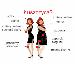 Stwardnienie rozsiane, którego objawy mogąmanifestowane w każdej osobie na różne sposoby, jest poważną chorobą. Luszczyca Diagnostyka I Eliminacja Ktt Alergikus Bioklinik Alergiom Mowimy Stop