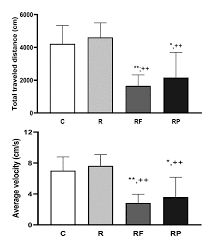 Acute effect of pregabalin
