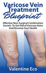 Women, women who have had multiple children, and obese persons are at a higher risk. Varicose Vein Treatment Blueprint Effective Non Surgical Combination Secrets To Prevent Get Rid Of Varicose Veins Revamp Your Health Kindle Edition By Eco Valentine Health Fitness Dieting Kindle Ebooks