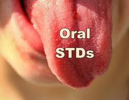 Sometimes they can be mistaken for other conditions, like when. Awareness Types Of Oral Stds Embry Women S Health