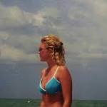  At 42, this woman has had 86 skin cancer surgeries