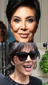 Kris Jenner's Cosmetic Secrets: Botox, Facelift, NO Nose Job?!, #krisjenner  #kardashians