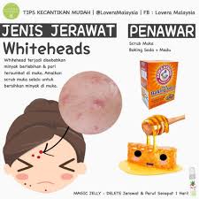 Baking soda adalah satu produk semulajadi, dimana jika anda menggabungkannya dengan produk yang betul, anda akan tidak akan guna peluntur dan bahan kimia lain untuk membersihkan rumah serta anda juga akan gantikan banyak produk yang anda gunakan untuk kebersihan diri dan dandanan anda. Soulusi On Twitter Kredit Lovera Malaysia Twitter