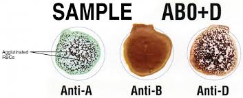 Blood Typing Anatomy And Physiology Ii