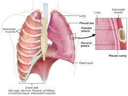 The frontal chest radiograph and axial chest ct images are viewed as if looking at the patient, with the patient's right side on the viewer's left. Pleural Cavity Wikipedia