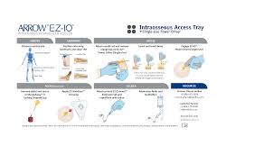 Image result for Intraosseous Access