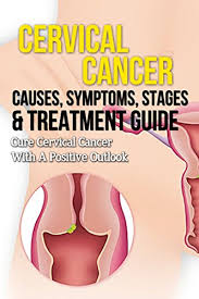 Most women are advised to schedule a pap test starting at age 21. Cervical Cancer Causes Symptoms Stages Treatment Guide Cure Cervical Cancer With A Positive Outlook Kindle Edition By Dixon Danielle Professional Technical Kindle Ebooks Amazon Com