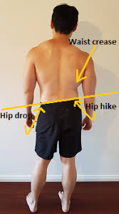 Mobilisation of the pelvis is also be necessary to aid leg length and in turn, help straighten the lower back and further up. How To Fix Scoliosis Best Exercises To Straighten Spine Posture Direct