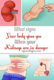 Pin On Heart Attack Prevention