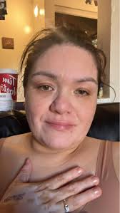 How do you handle when a family member says .. "it's manageable " When it  comes to Lupus Im new to this and I feel like that's super dismissive I  haven't quite