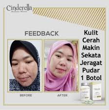 Oleh sebab itu, sebelum anda menjalankan perawatan untuk memutihkan kulit muka dan tubuh anda dengan beberapa cara di atas. Cinderella Miracle World Kurus Putih Cantik Semulajadi Produk Putihkan Kulit Berkesan