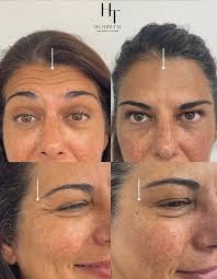 Dr Haim Tal l קליניקה לאסתטיקה רפואית‎ (@dr.haim_tal) • Instagram photos  and videos