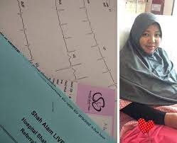Sakit perut juga bisa disebabkan karena masuk angin. Ada Ketulan Besar Di Perut Bila Ditekan Sakit Disangka Angin Rupanya Cyst Ibu Ni Kongsikan Deritanya Keluarga
