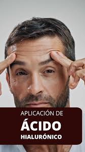 ¿Sabías que los tratamientos de Bótox y Ácido Hialurónico tienen un diseño  específico para la piel del hombre? Gracias a sus características únicas,  logramos un rejuvenecimiento discreto y natural. El ...