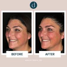 Ashley Bell Reich (@laser.nurse.ashley) • Instagram photos and videos