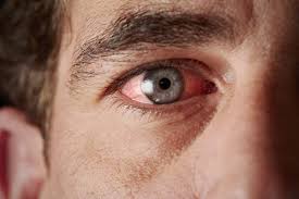 Can i go blind if my dry eyes are untreated? Diabetes Can Make You Go Blind