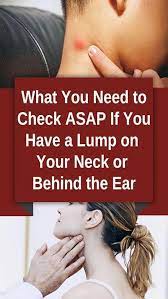 Do You Might Have A Lump On Your Neck Back Or Behind Your Ear This Can Be What It Means Lumpunderneathskin Hardlumponskin Lump Behind Ear Ear Neck
