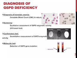 Image result for G6PD Deficiency Detection