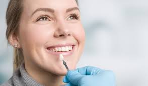 What are dental veneers and what are they made from?