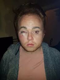 Beaten senseless for an iPhone