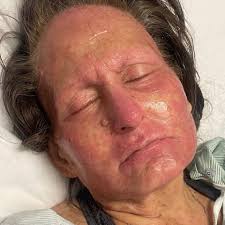 Fundraiser for Stephanie Desforges by Jennifer Luquette : Miracle Fund:  Helping Steph DesForges Battle Cancer Round 4