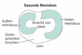 Diese struktur befindet sich zwischen hüfte und schaft. Meniskusverletzungen Apotheken Umschau