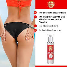 It can also be filled with pus to become yellow or clear. Amazon Com Anti Acne Buttocks Thigh Treatment Clears Away Acne Pimples And Ingrown Hairs For The Buttocks And Thigh Area Prevents Future Breakouts Beauty