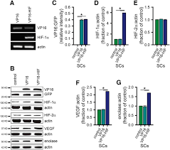 Hif is a transcriptional factor that plays a role in the physiologic responses to hypoxia. Hypoxia Inducible Factor 1a Hif 1a Counteracts The Acute Death Of Cells Transplanted Into The Injured Spinal Cord Eneuro
