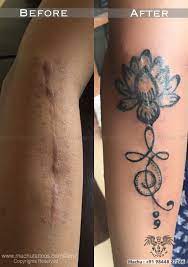 Complete Surgeical Scar Cover By Tattoo Done By Suresh Machu From Machu Tattoo Studio The Best Tattoo Artist In B Tattoo Artists Cool Tattoos Best Tattoo Shops